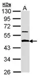 Anti-APBB3 antibody [N3C3-2] used in Western Blot (WB). GTX110405