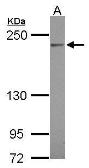 Anti-C4 / C4b antibody [N1N2-2], N-term used in Western Blot (WB). GTX110413