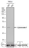 Anti-Cytokeratin 7 antibody [N2C2], Internal used in Western Blot (WB). GTX110414