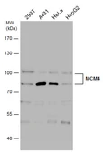 Anti-MCM4 antibody used in Western Blot (WB). GTX110424