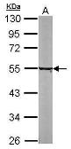 Anti-alpha Tubulin 8 antibody [N1C1-2] used in Western Blot (WB). GTX110432