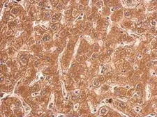 Anti-TFR2 antibody [N3C2], Internal used in IHC (Paraffin sections) (IHC-P). GTX110441