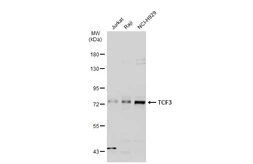 Anti-TCF3 / E2A antibody used in Western Blot (WB). GTX110458