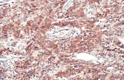 Anti-CD74 antibody [N1N2], N-term used in IHC (Paraffin sections) (IHC-P). GTX110477