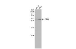 Anti-CD74 antibody [N1N2], N-term used in Western Blot (WB). GTX110477