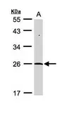 Anti-SENP8 antibody [N1N2], N-term used in Western Blot (WB). GTX110478