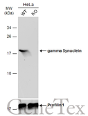 Anti-gamma Synuclein antibody used in Western Blot (WB). GTX110483