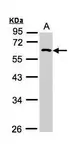 Anti-RGS11 antibody [N2C1], Internal used in Western Blot (WB). GTX110490