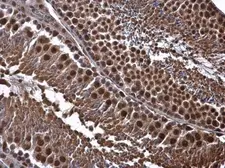 Anti-CDK8 antibody [C3], C-term used in IHC (Paraffin sections) (IHC-P). GTX110495