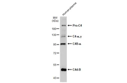 Anti-C4 / C4d antibody [C2], C-term used in Western Blot (WB). GTX110502