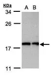 Anti-Apc11 antibody [N2C3] used in Western Blot (WB). GTX110506