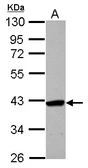 Anti-SMYD5 antibody [C2C3], C-term used in Western Blot (WB). GTX110518
