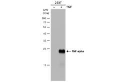 Anti-TNF alpha antibody used in Western Blot (WB). GTX110520