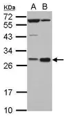 Anti-Hex antibody used in Western Blot (WB). GTX110523