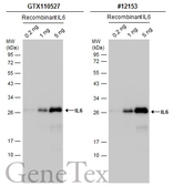 Anti-IL6 antibody used in Western Blot (WB). GTX110527