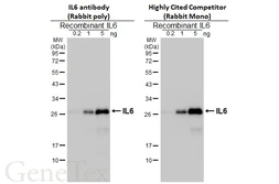 Anti-IL6 antibody used in Western Blot (WB). GTX110527