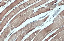 Anti-CSRP3 antibody used in IHC (Paraffin sections) (IHC-P). GTX110536