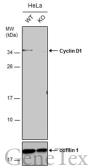 Anti-Cyclin D1 antibody [N1C3-2] used in Western Blot (WB). GTX110541
