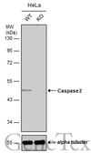 Anti-Caspase 2 antibody used in Western Blot (WB). GTX110542