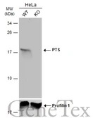Anti-PTS antibody [N1C3] used in Western Blot (WB). GTX110549