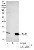 Anti-MGMT antibody used in Immunoprecipitation (IP). GTX110551