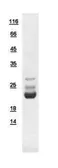 Human Bid protein, His tag. GTX110568-pro