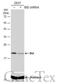 Anti-Bid antibody [N1C3-2] used in Western Blot (WB). GTX110568
