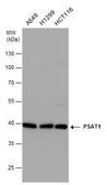 Anti-PSAT1 antibody [N1C3] used in Western Blot (WB). GTX110576