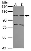 Anti-MSH2 antibody [C2C3], C-term used in Western Blot (WB). GTX110582