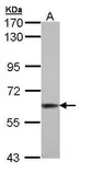 Anti-TrxR1 antibody used in Western Blot (WB). GTX110589