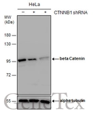 Anti-beta Catenin antibody used in Western Blot (WB). GTX110594