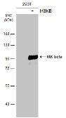 Anti-IKK beta antibody used in Western Blot (WB). GTX110598