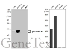 Anti-Cytokeratin 20 antibody [N2C2], Internal used in Western Blot (WB). GTX110600