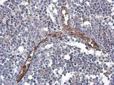 Anti-CD31 antibody [N3C2], Internal used in IHC (Paraffin sections) (IHC-P). GTX110602