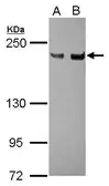 Anti-XPG antibody [C2C3], C-term used in Western Blot (WB). GTX110609