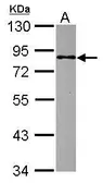 Anti-MBD1 antibody [N2C2], Internal used in Western Blot (WB). GTX110612