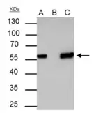 Anti-AKT1 antibody used in Immunoprecipitation (IP). GTX110613