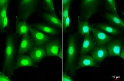 Anti-DDX3 antibody [N3C2], Internal used in Immunocytochemistry/ Immunofluorescence (ICC/IF). GTX110614