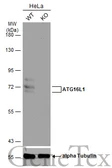 Anti-ATG16L1 antibody [N2C1], Internal used in Western Blot (WB). GTX110619