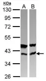 Anti-CAB39 antibody used in Western Blot (WB). GTX110628