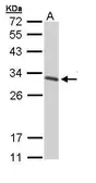 Anti-14-3-3 gamma antibody used in Western Blot (WB). GTX110629