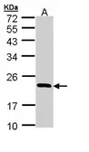 Anti-RBP4 antibody used in Western Blot (WB). GTX110632