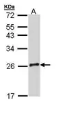 Anti-GH-V antibody used in Western Blot (WB). GTX110633