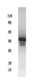 Human HAT1 protein, His tag. GTX110643-pro