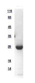 Human RAB6A protein, His tag. GTX110646-pro