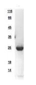 Human RAB6A protein, His tag. GTX110646-pro