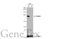 Anti-RAB6A antibody used in Western Blot (WB). GTX110646