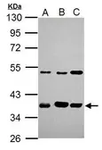Anti-ARA9 antibody [N1C3] used in Western Blot (WB). GTX110665