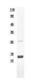 Human MGP protein, His tag. GTX110676-pro