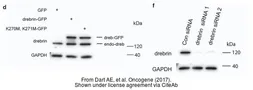 Anti-Drebrin antibody used in Western Blot (WB). GTX11068